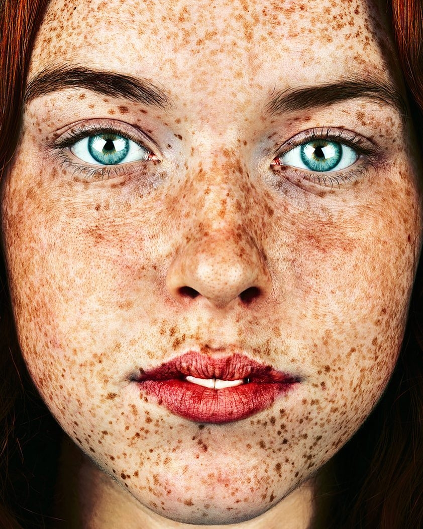 Тег: #freckles.